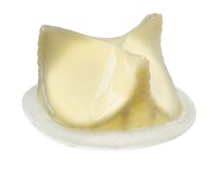 Trifecta Heart Valve Replacement_St Jude Medical